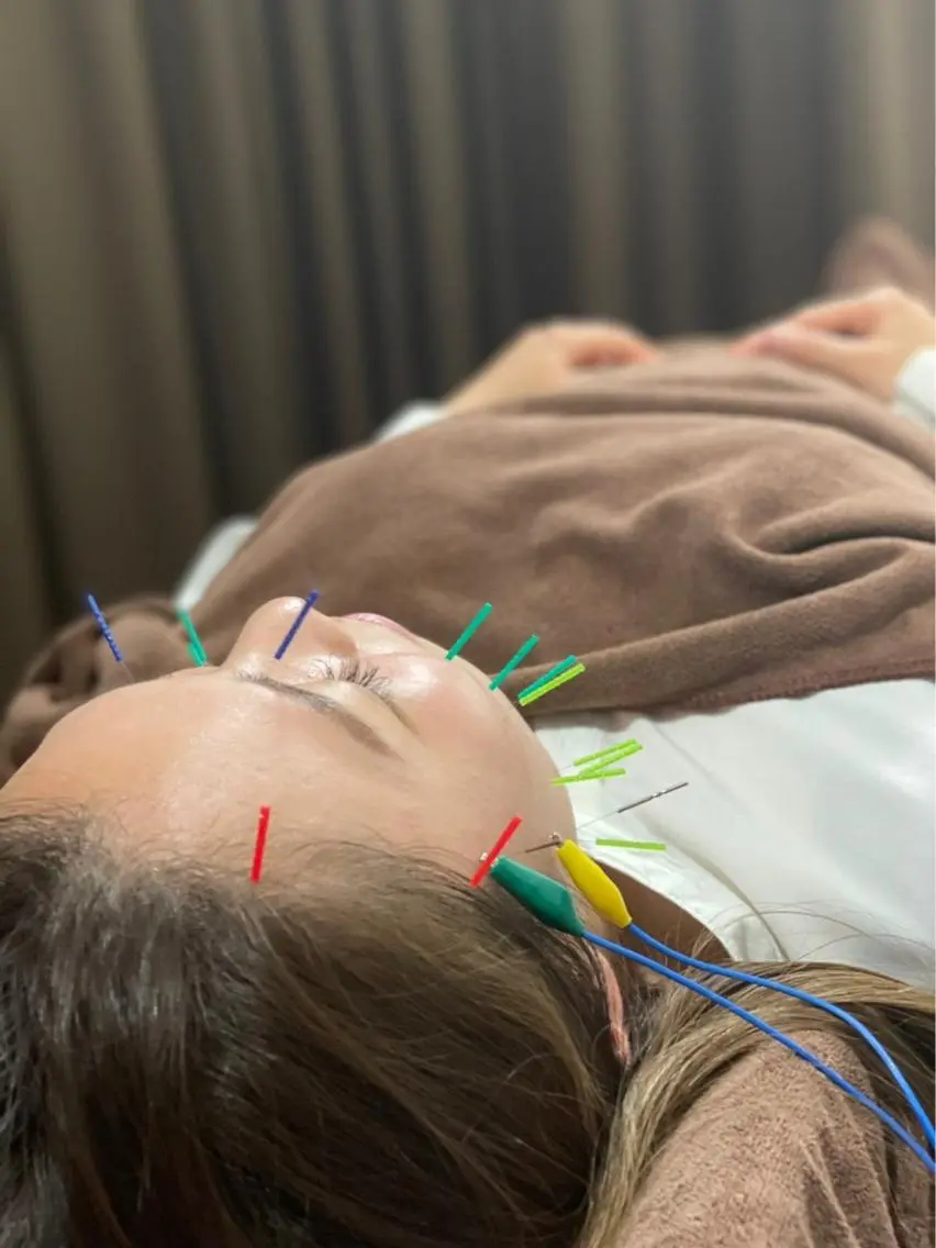 肌荒れに😵電気美容鍼&リンパマッサージの写真