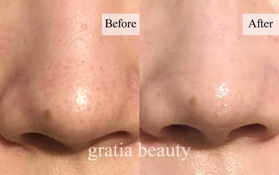 エステ gratia salonのエステ・リラクイメージ