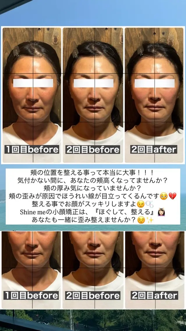 エステ リラク 💎後悔させない小顔 矯正💎イトヤマ🌱のエステ・リラクイメージ