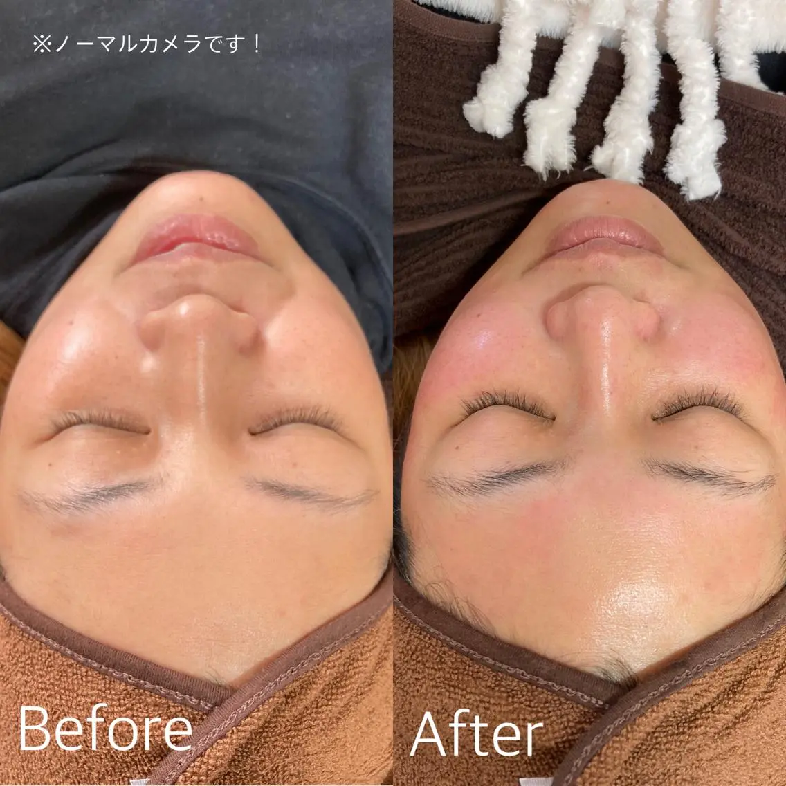 【艶肌WAX】お肌のためのワックスです✨幹細胞美容液導入付きの写真