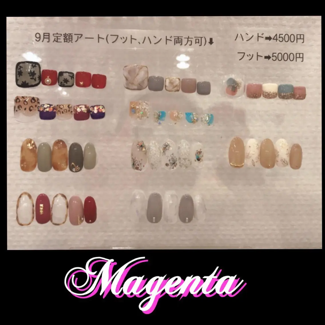 ネイル ♢ME2ROOM♢ #巻き爪#リラクのネイルデザイン