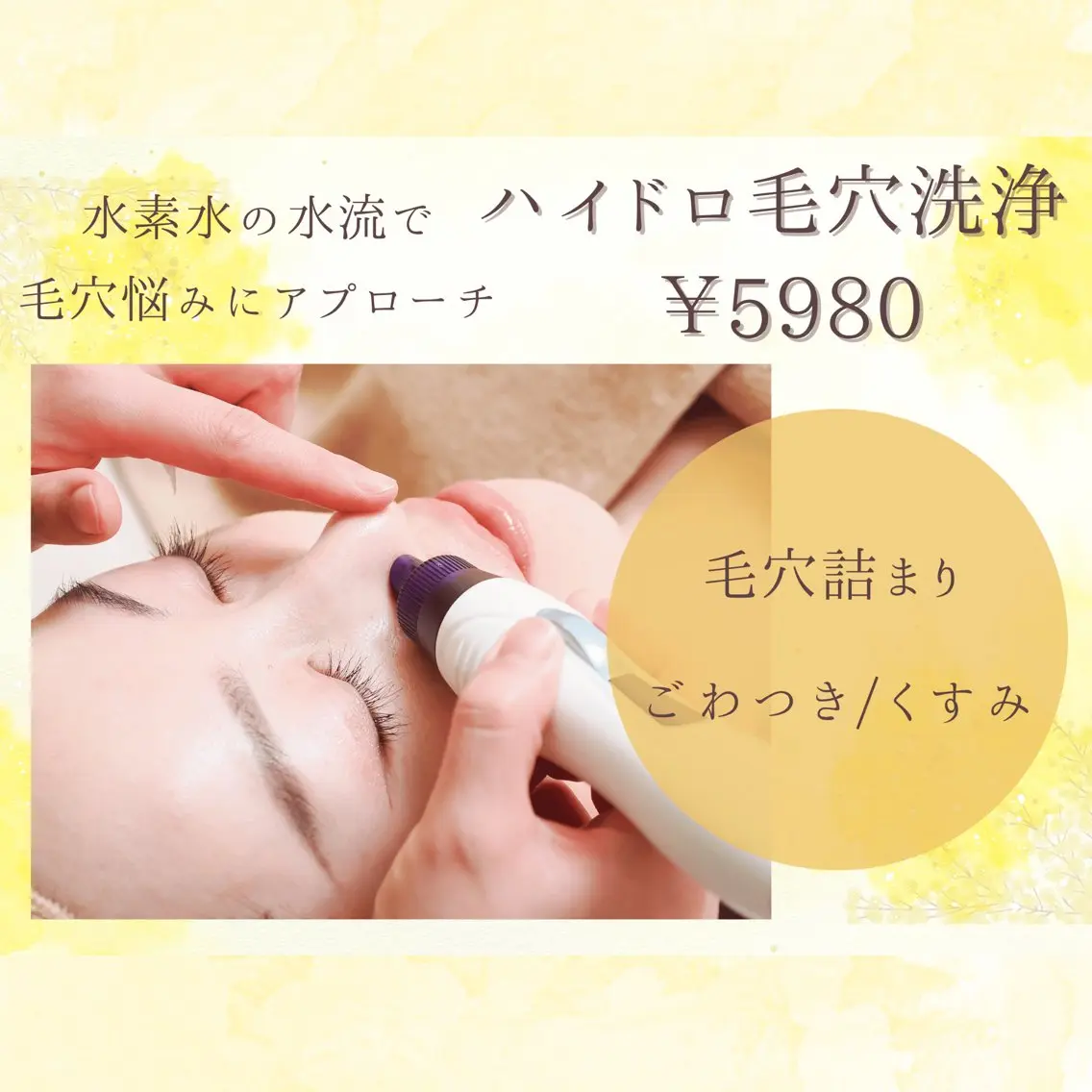 【黒ずみ撃退】ハイドロ毛穴洗浄＋美容液導入✨の写真