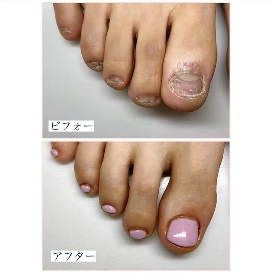 ネイル ネイルサロン アリュームのネイルデザイン