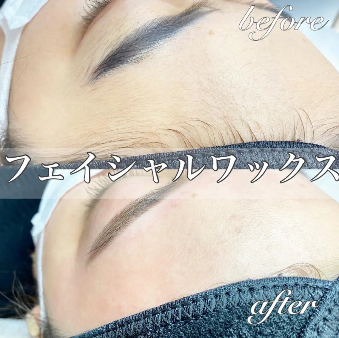 フェイシャルワックス＋鎮静パック付きの写真