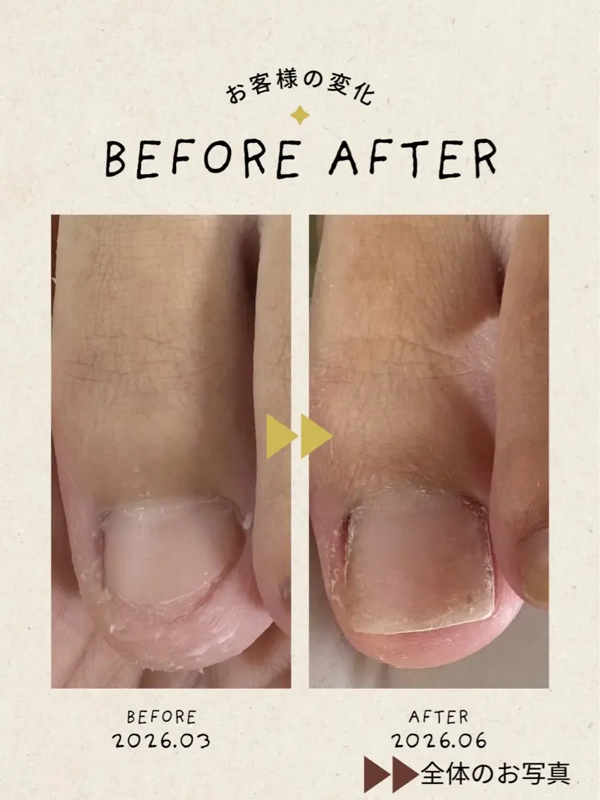 ネイル 長さ出し ジェルネイル 卒業式 フットネイル nail salon petillantのネイルデザイン