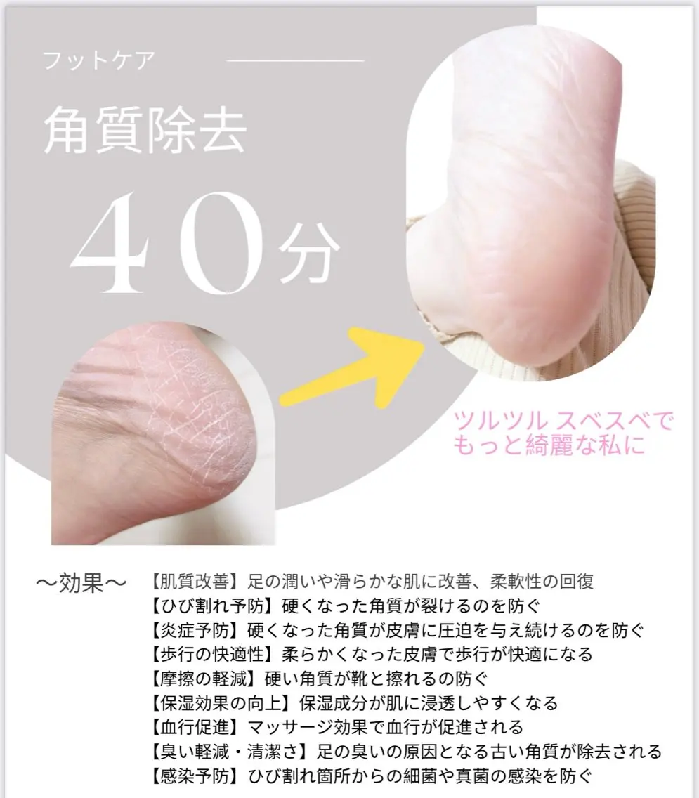 角質除去の写真