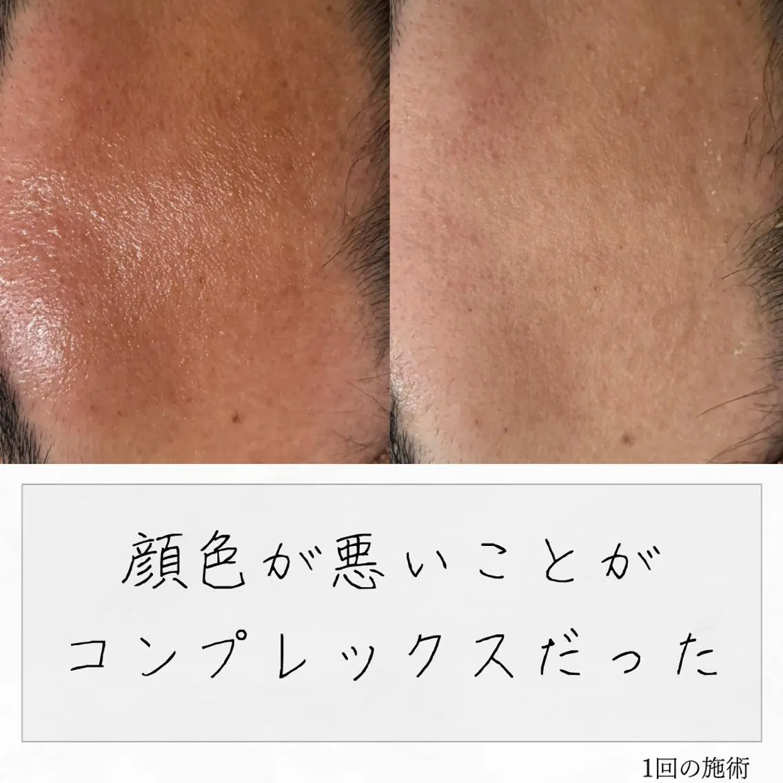 ニキビ経験者が施術 する専門サロン🌻のエステ・リラクイメージ