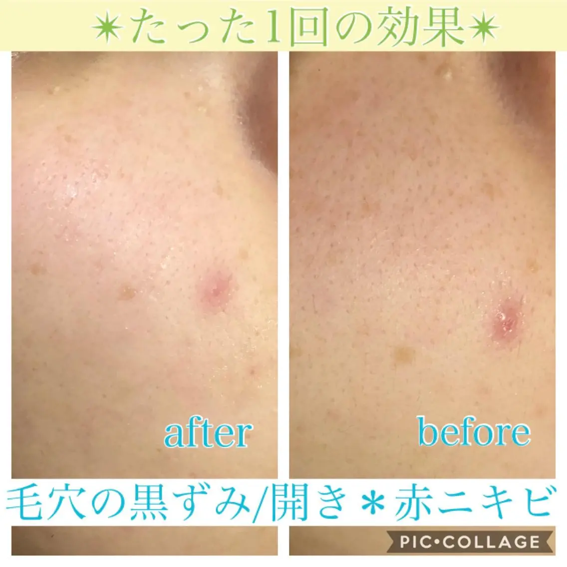 セミロング カラー パーマ ヘアアレンジ キッズ ネイル マツエク・マツパ エステ リラク EnsorClair 代表 野口真央のエステ・リラクイメージ