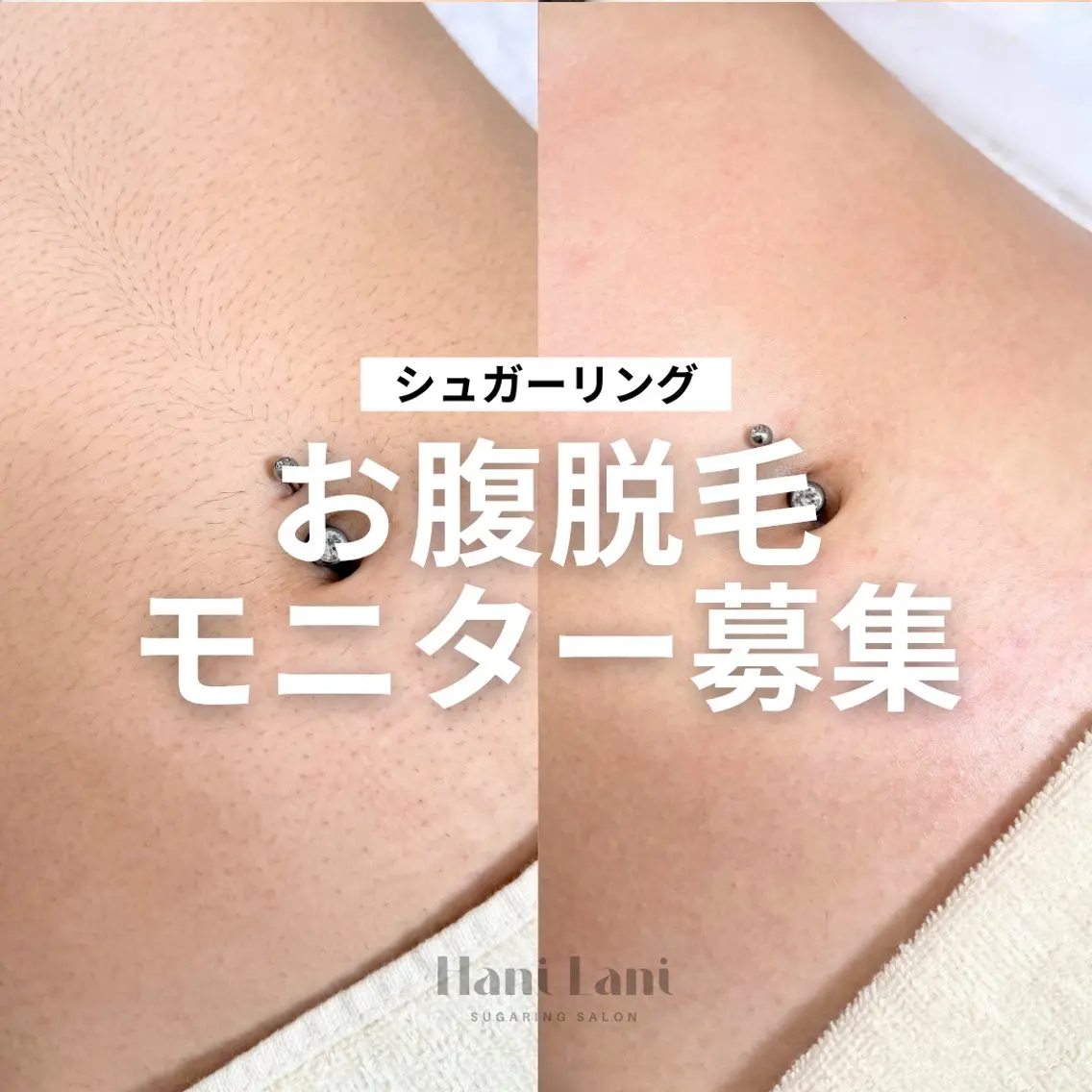 【モニター募集】お腹🍊シュガーリングの写真