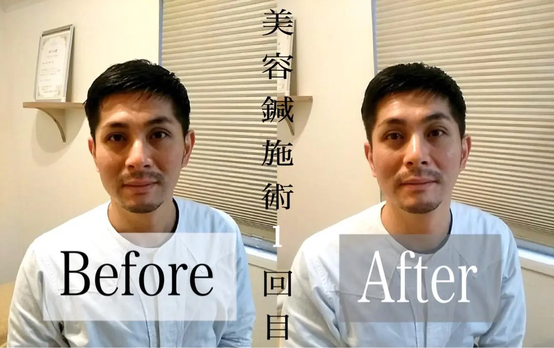 鍼灸 Refineのその他イメージ