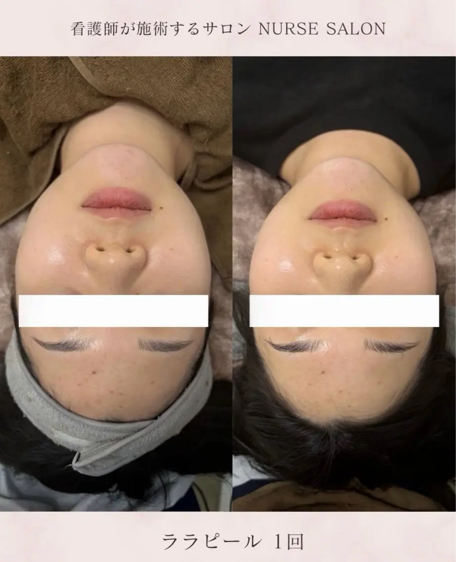 エステ 韓国式肌管理ナスサロ 看護師 Ayaのエステ・リラクイメージ