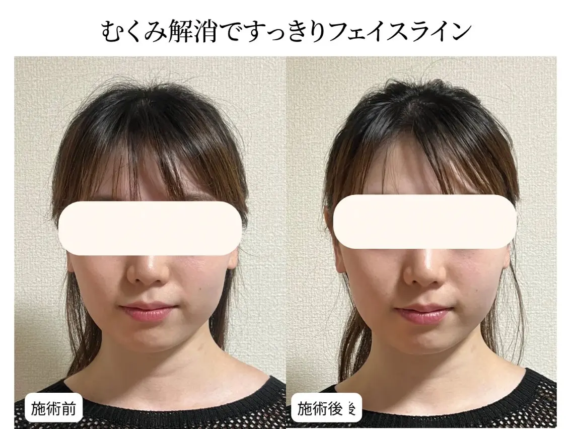 エステ 小顔矯正×毛穴サロン DRRAMSPA町田のエステ・リラクイメージ