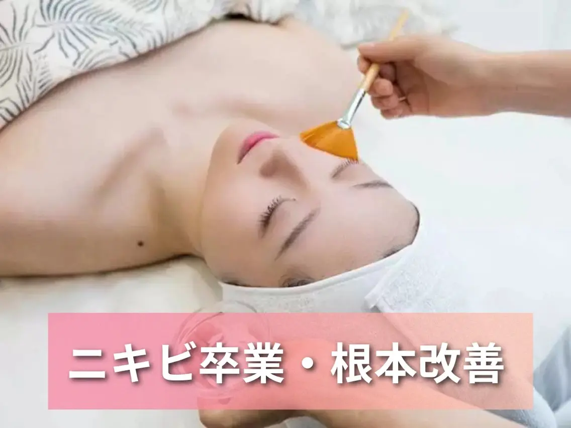 人気No.1【毛穴・ニキビ徹底ケア】最新スノーピール❄️白玉のような透明感＆陶器肌へ 9500→7500の写真