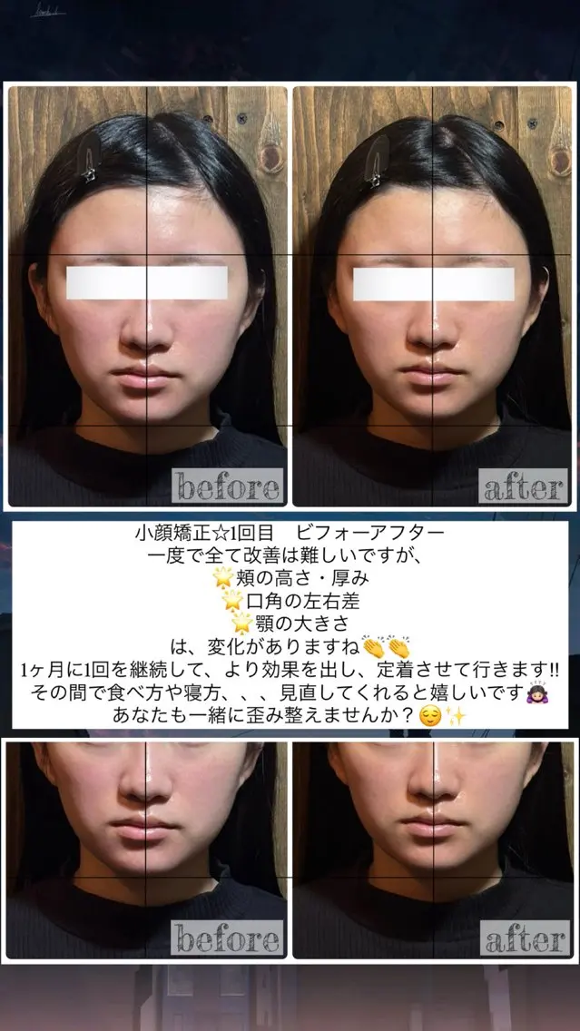 エステ リラク 💎後悔させない小顔 矯正💎イトヤマ🌱のエステ・リラクイメージ
