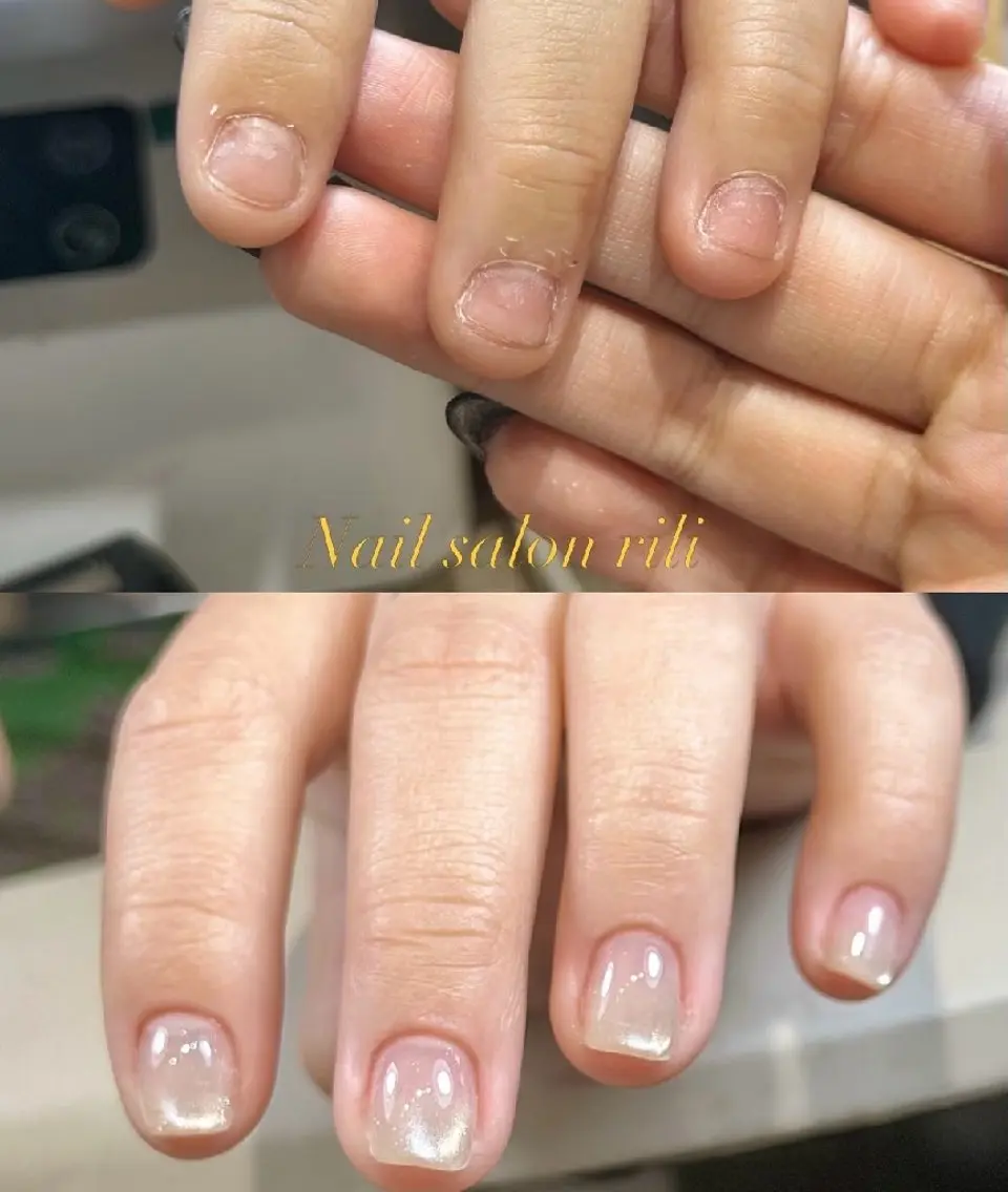 ネイル Natumiシンプル デザイン/深爪矯正のネイルデザイン