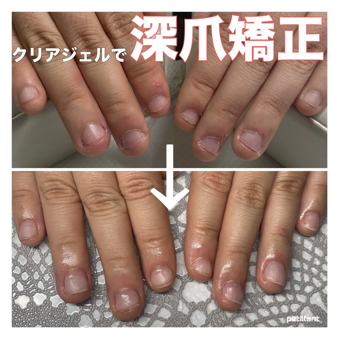 ネイル クリアネイル ジェルネイル nail salon petillantのネイルデザイン