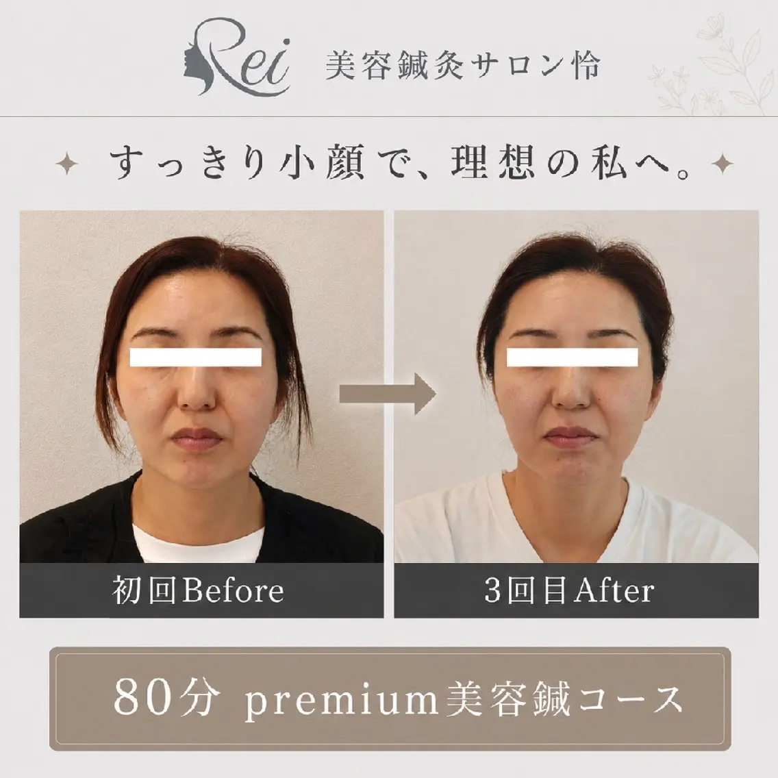 エステ リラク 美容鍼灸サロン怜 -Rei-のエステ・リラクイメージ