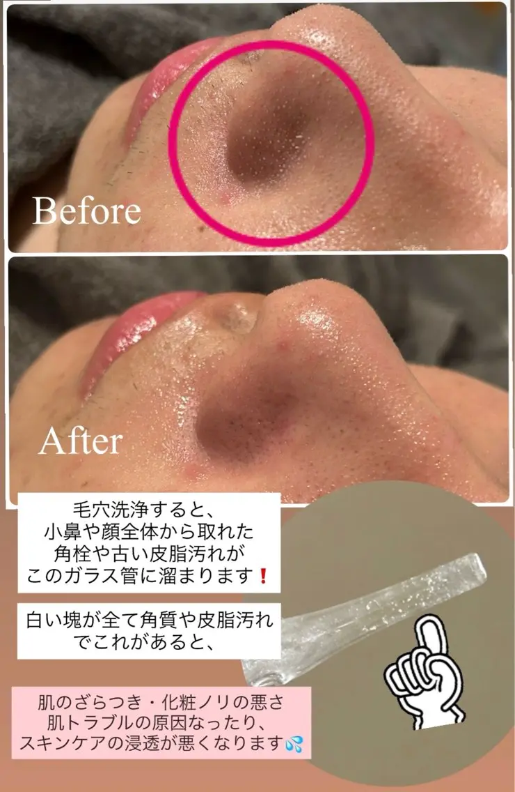 その他 木田 亜実のエステ・リラクイメージ
