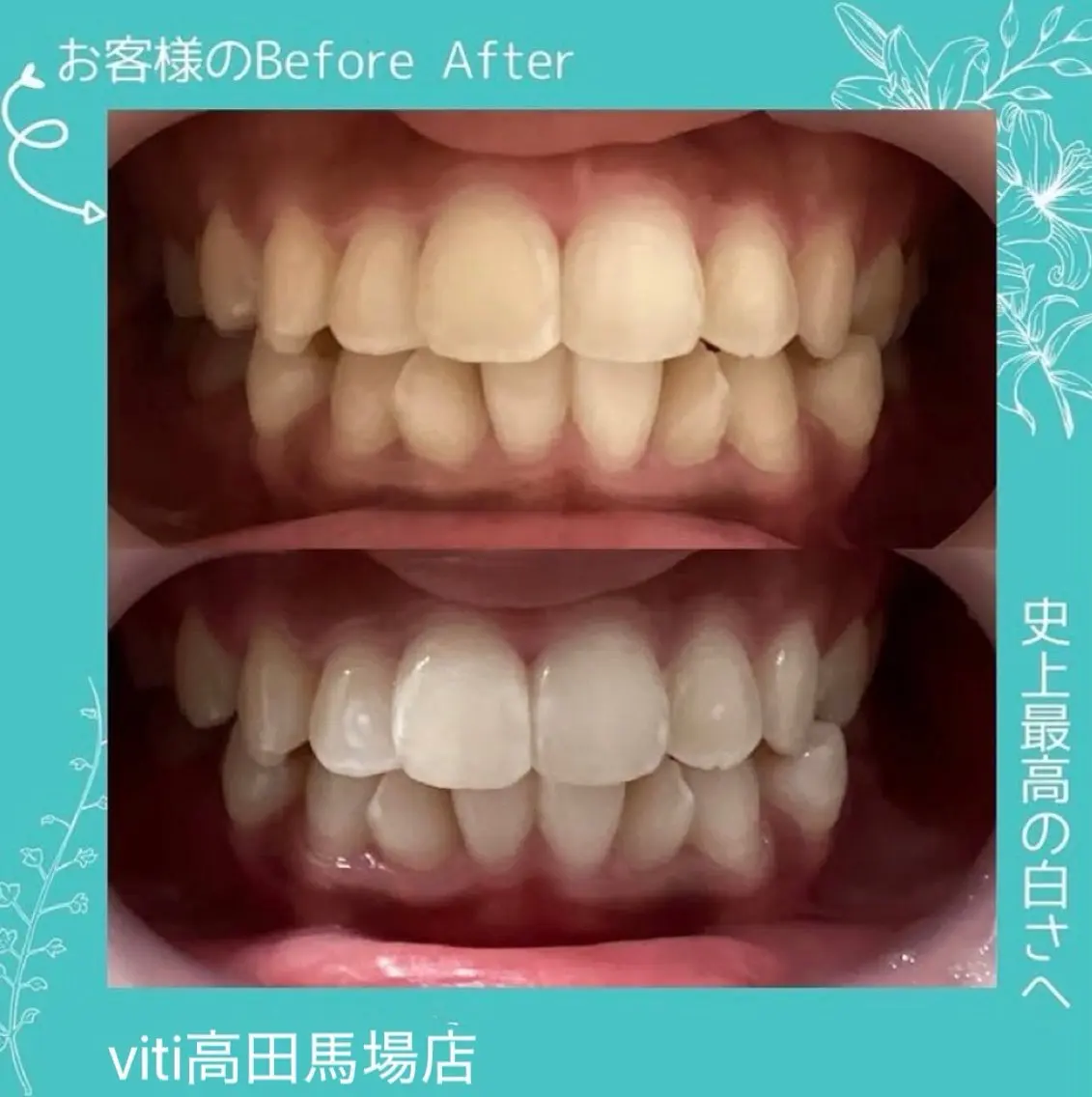 その他 viti 高田馬場店のその他イメージ