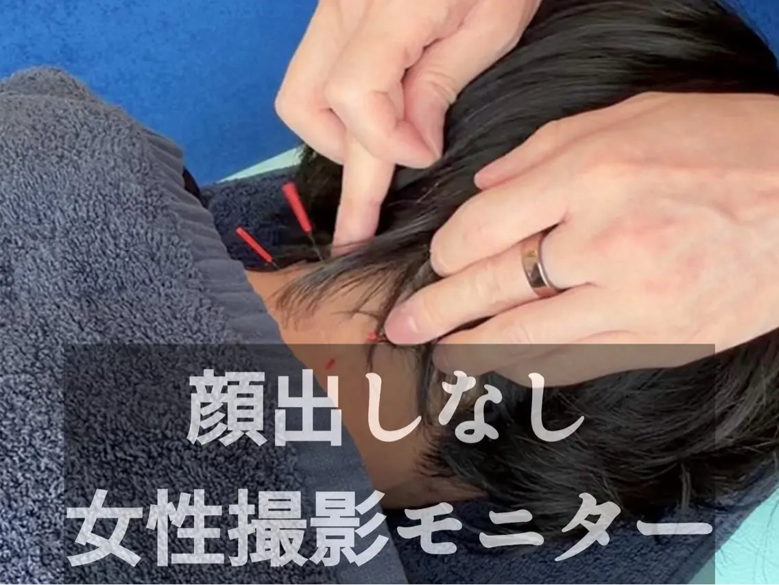 【顔出しなし女性モニター】首こり・肩こり鍼×整体 30分の写真
