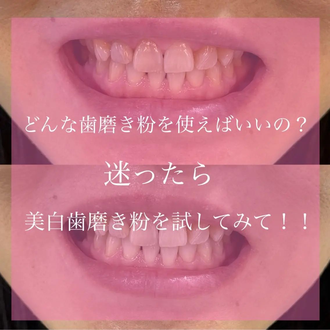 Livicate 💗🧁🎀🦋のマツエク・マツパデザイン