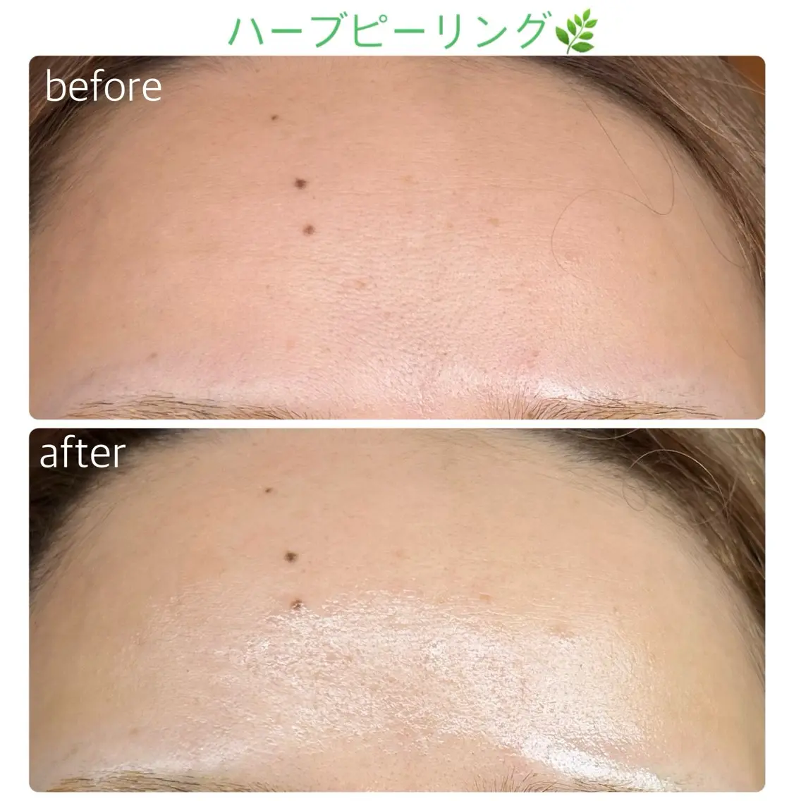 エステ soposilma 🧸今季OPENのマツエク・マツパデザイン