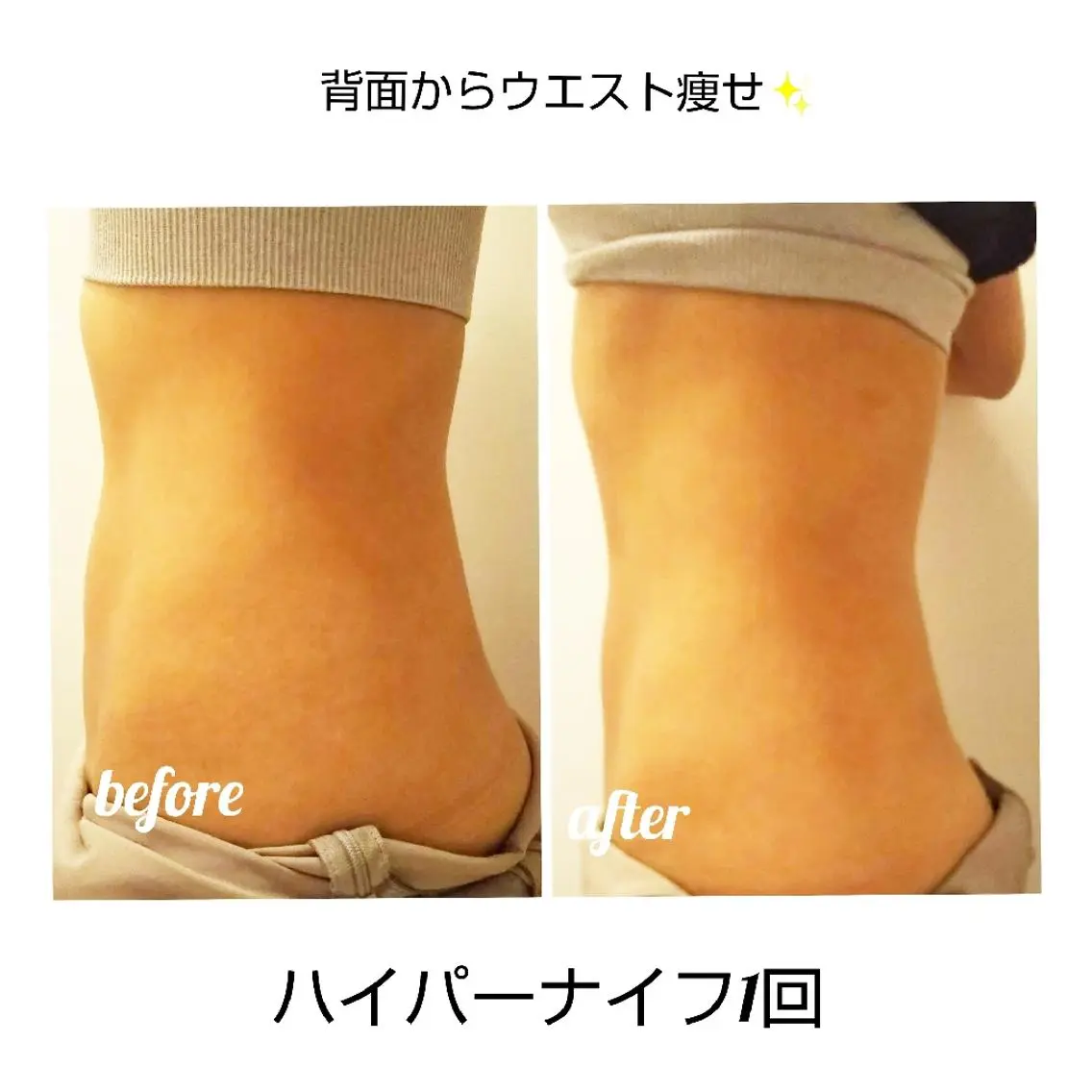 ニキビ•ニキビ跡改善 salon varyのエステ・リラクイメージ