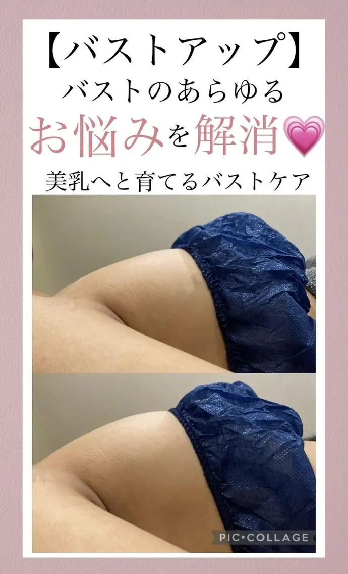 【バストアップのお悩み解決】高技術×知識量◎ボリューム/形崩れ/垂れ/萎みの写真