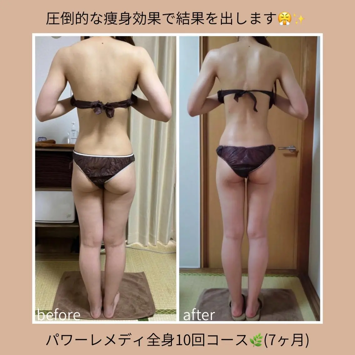 《本気痩せ×疲労改善 》 BILOOPのエステ・リラクイメージ