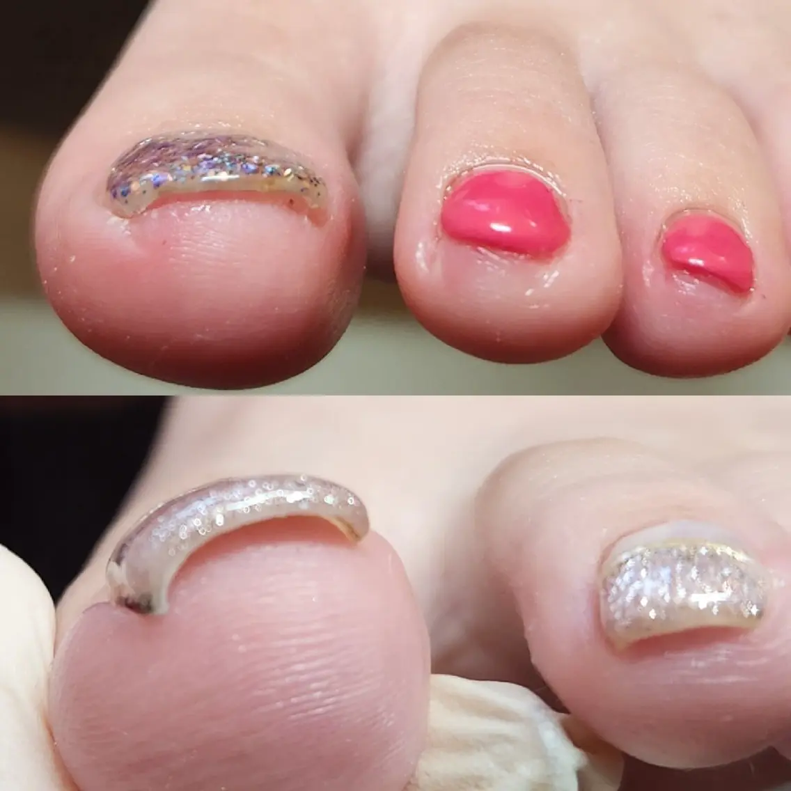ネイル ジェルネイル Micky nail chikushinoのその他イメージ