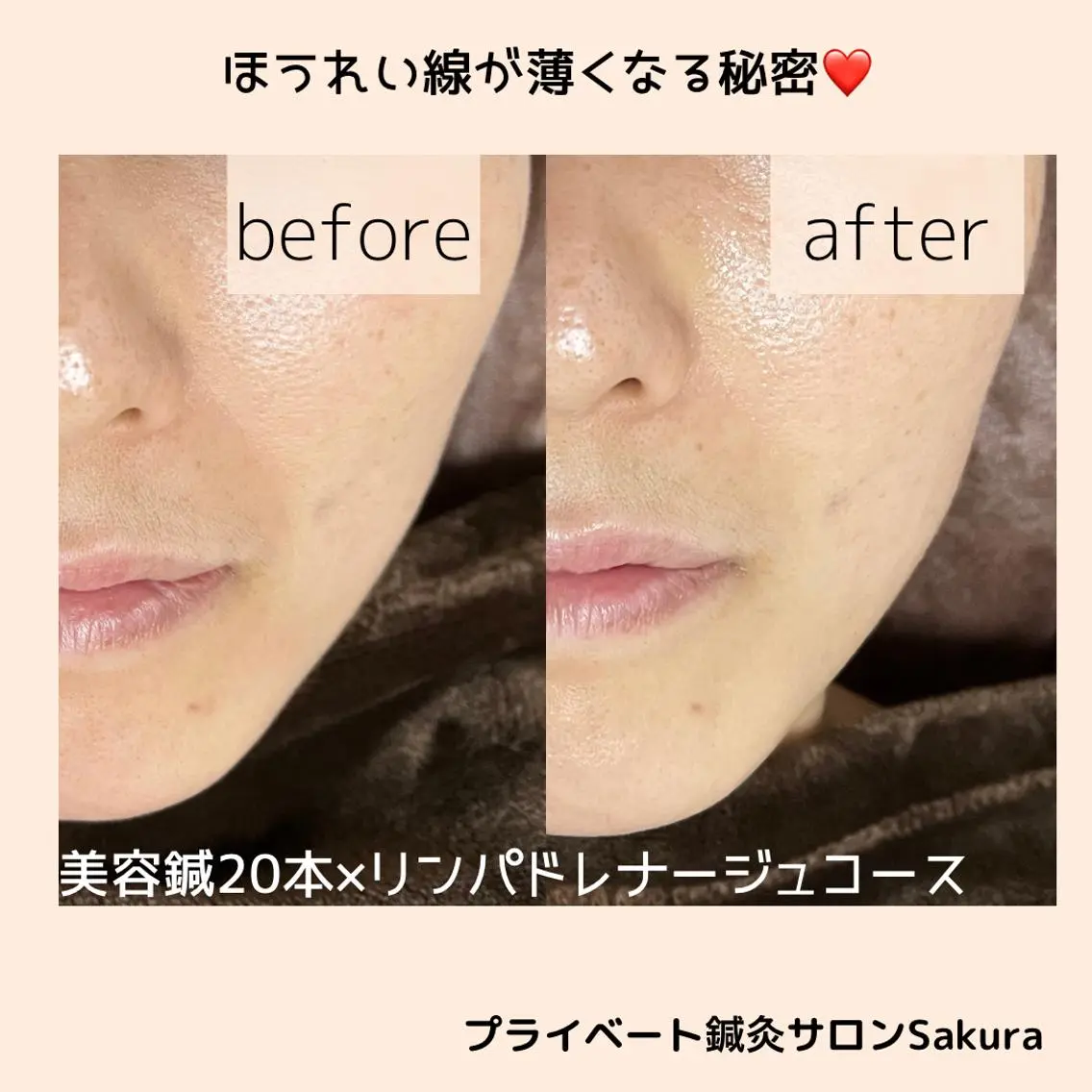 エステ 鍼灸サロン Sakuraのエステ・リラクイメージ