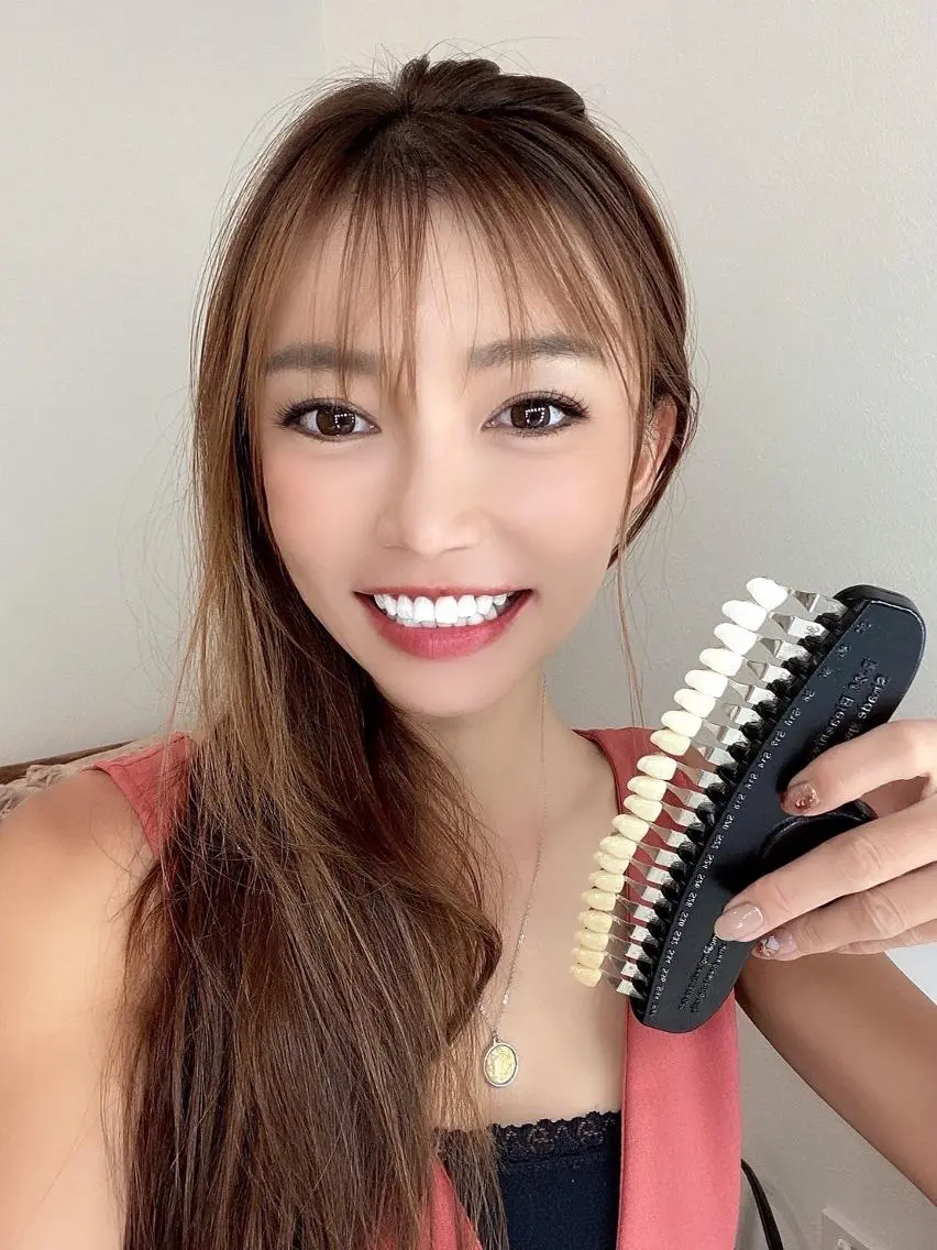 【初回体験✨】お試しホワイトニング計30分照射 自然な白さへ、お試しホワイトニングの写真