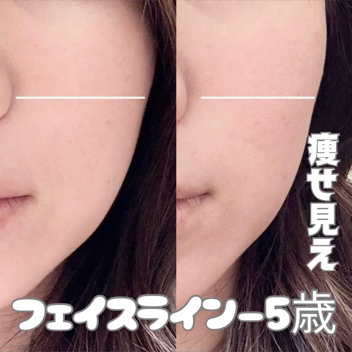 エステ Balance facialのその他イメージ