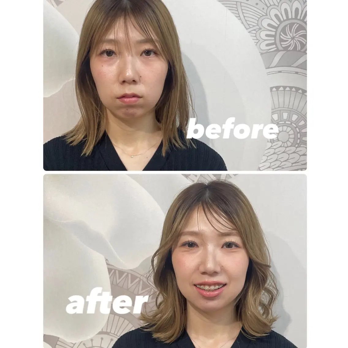 その他 常田 佳奈子のその他イメージ