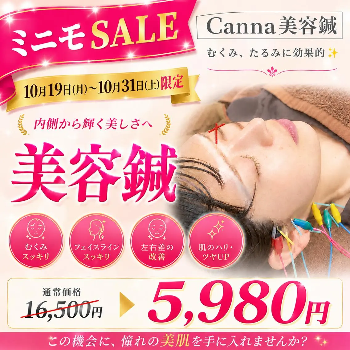 ミニモSALE!【人気No.2 】【浮腫み/肩こり/くすみ】90分⭐️美容鍼(顔鍼+身体鍼+フェイシャルマッサージ)の写真