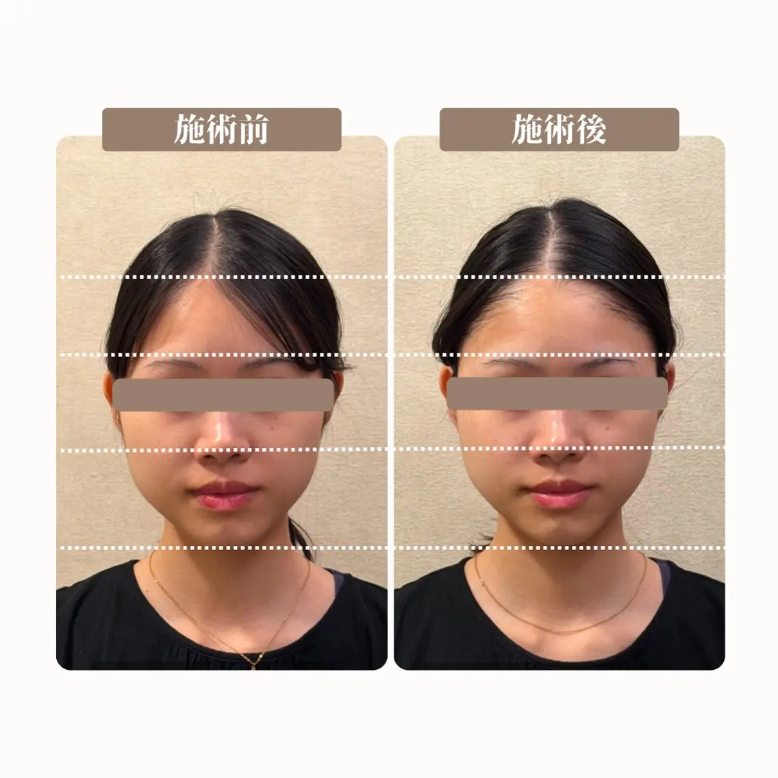 エステ BLANCIA 銀座のエステ・リラクイメージ