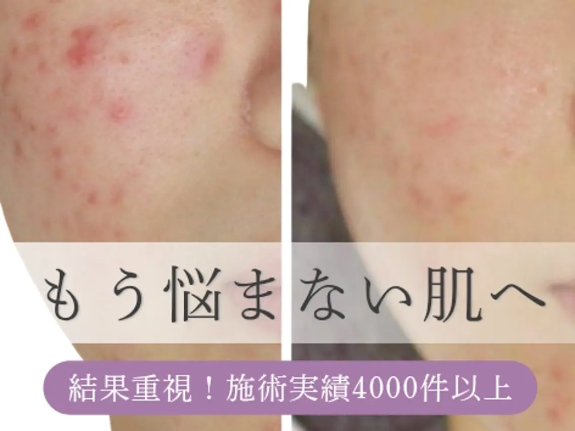 エステサロン NICOLIのエステ・リラクイメージ