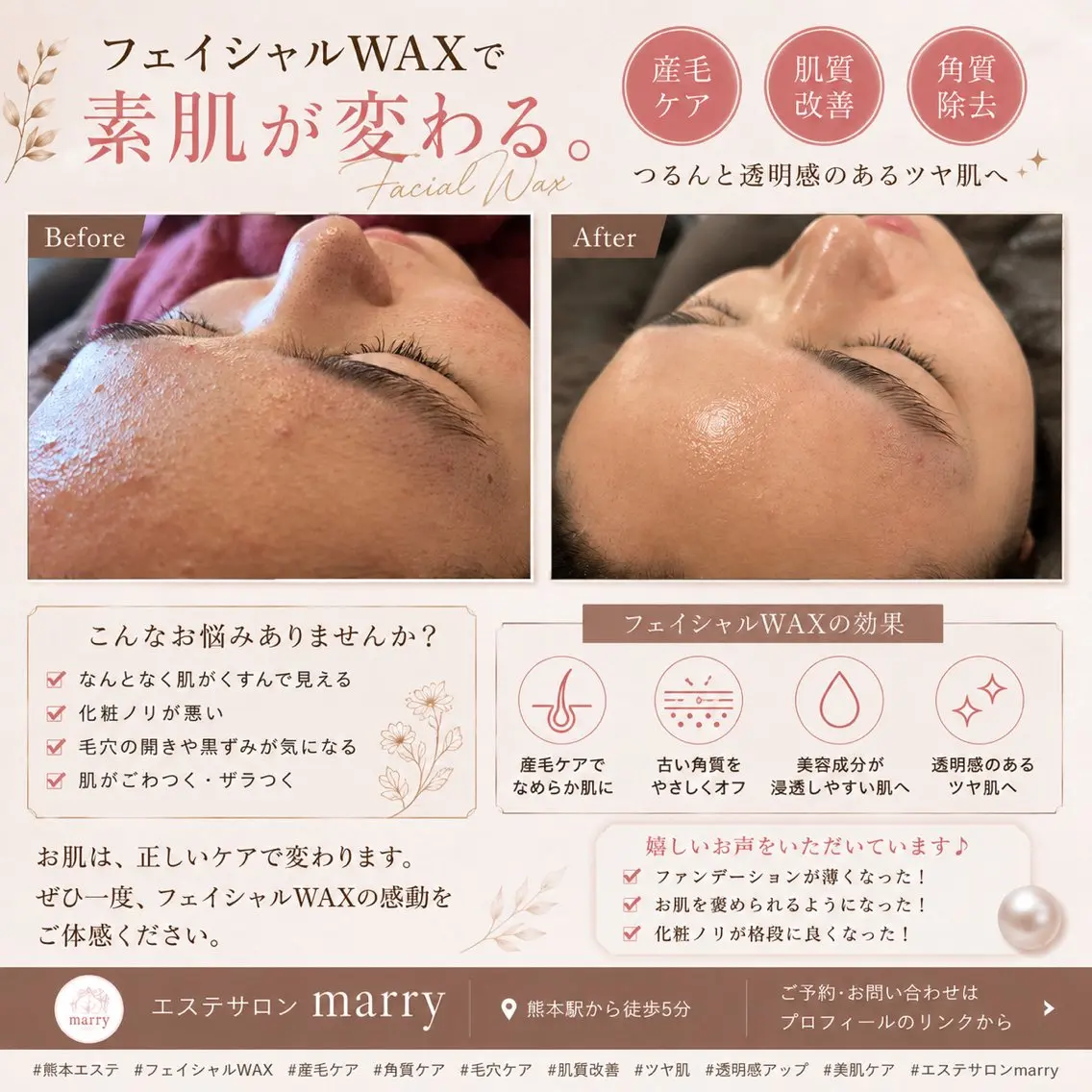 エステサロン marryのエステ・リラクイメージ