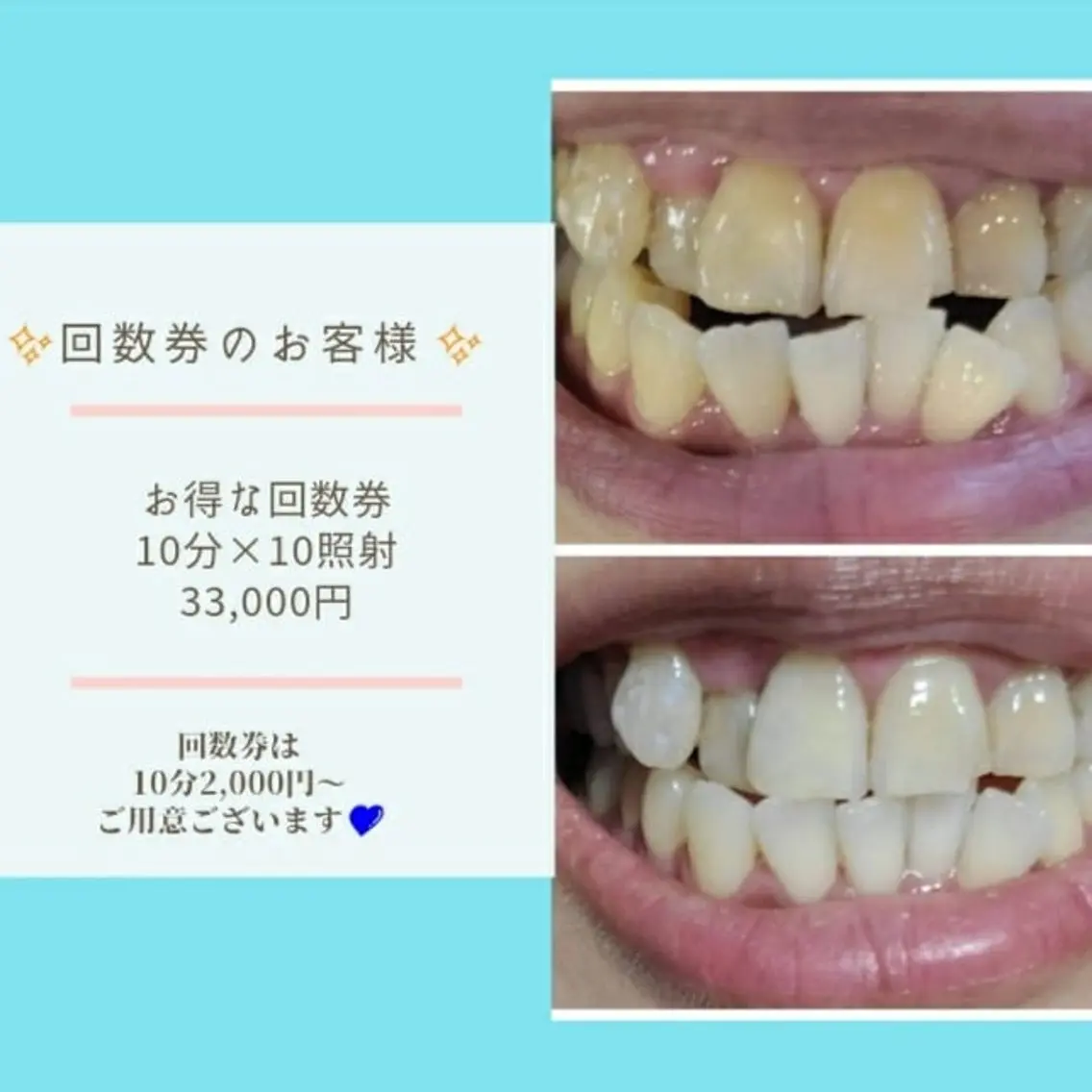 その他 五十嵐 蓮のその他イメージ