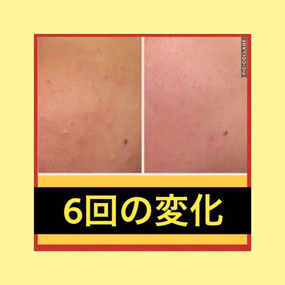 ミディアム パーマ ヘアアレンジ メンズ キッズ ネイル マツエク・マツパ ニキビ・肌質改善専門 ♡人生が変わるサロンのエステ・リラクイメージ