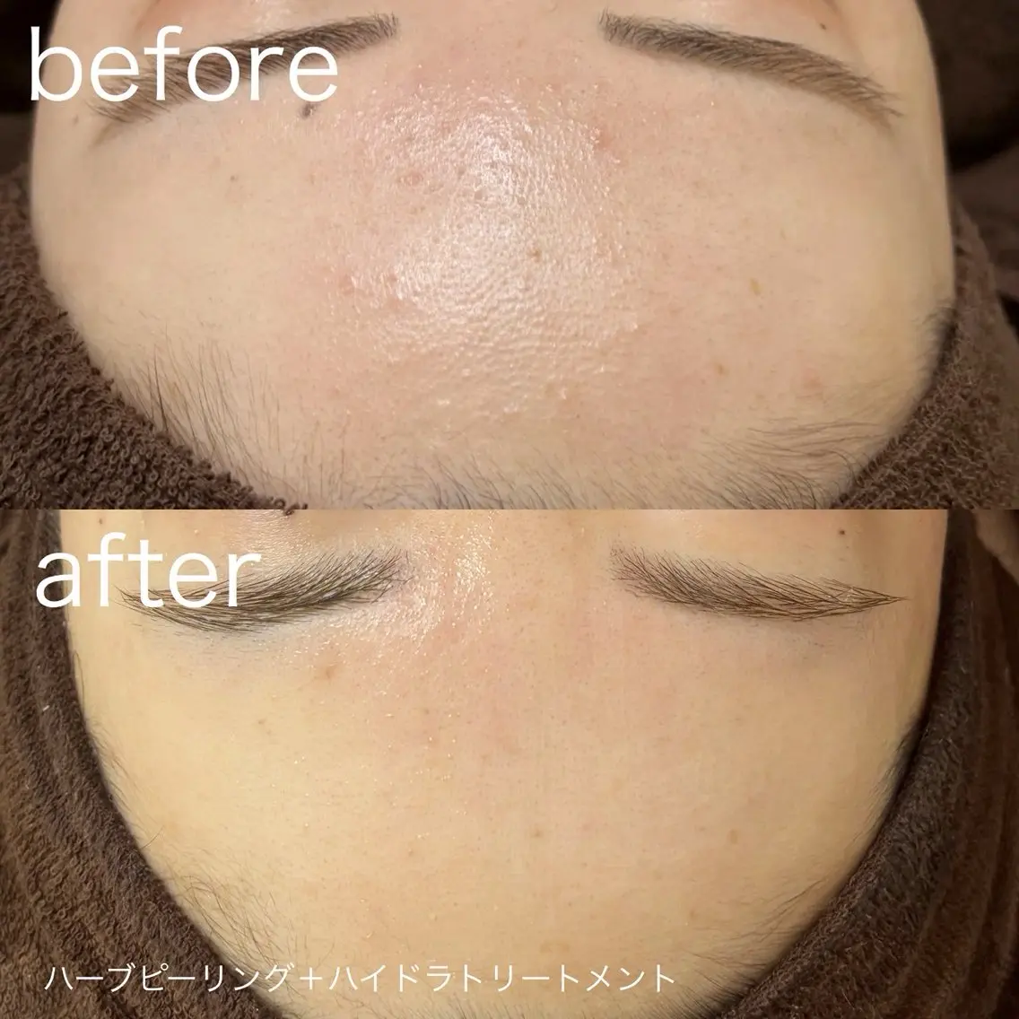脱毛 lulularico Yuのネイルデザイン