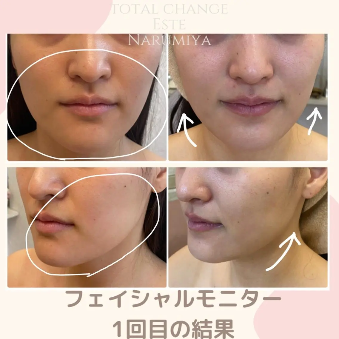 エステ 辻 佐耶のエステ・リラクイメージ