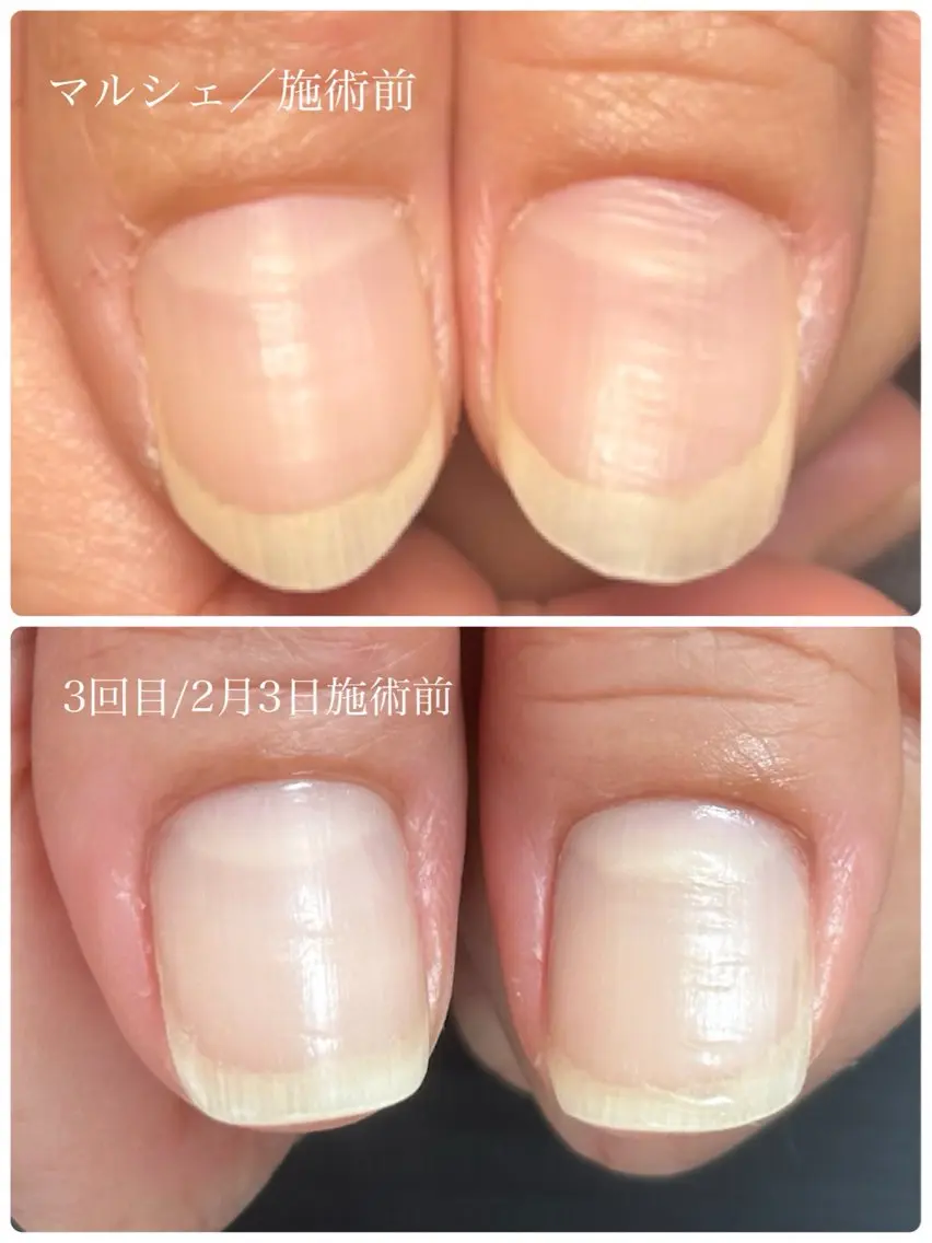 ネイル ハンドネイル Alo.nail アロ•ネイルのネイルデザイン