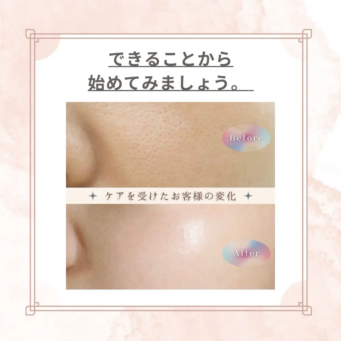 マツエク・マツパ エステ リラク 愛維美水光美肌専門店 メンズレディースokのエステ・リラクイメージ