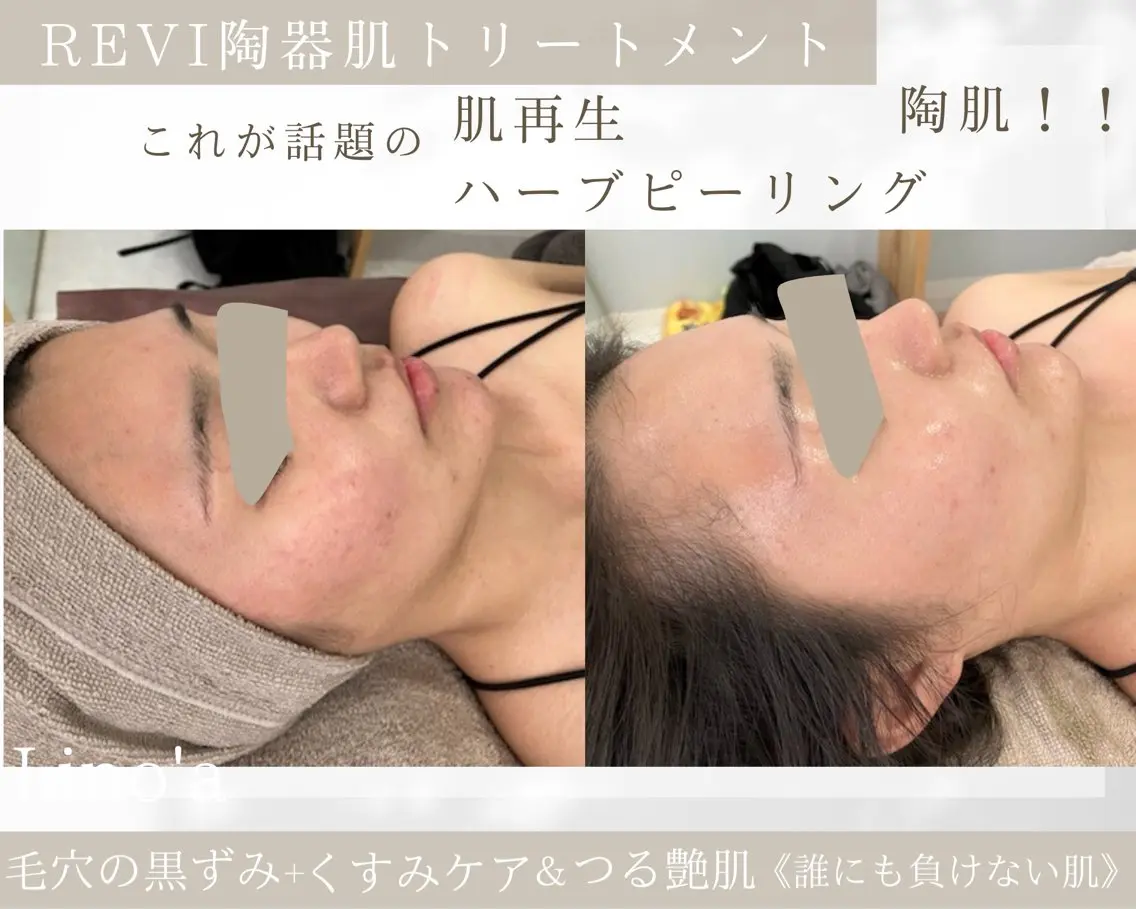 エステ リラク Salon💫 Lino'a柏店のエステ・リラクイメージ