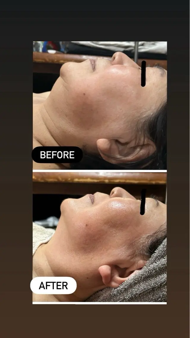 lymph coconのエステ・リラクイメージ