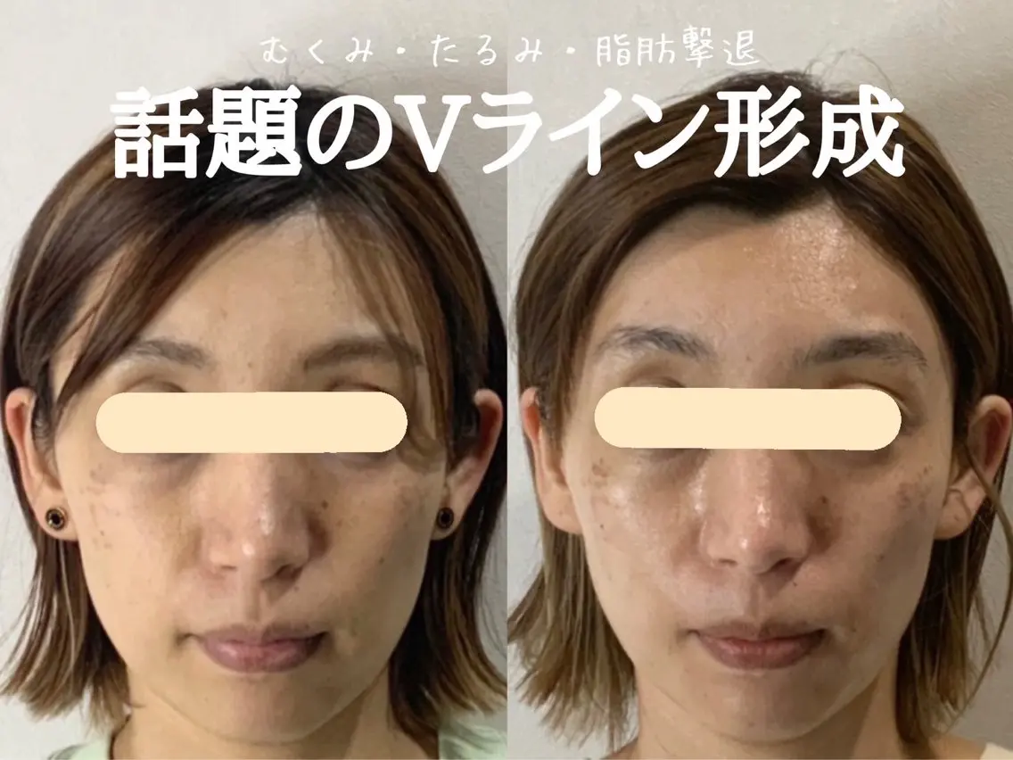 エステ リラク 最速小顔・肌質管理 espoirマキのエステ・リラクイメージ