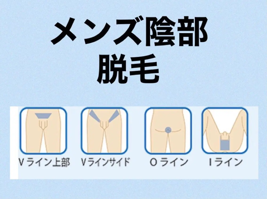 ❤️🔥75%オフ🤩清潔感UP 女子モテUP☝️🔹メンズ脱毛🔹VIO脱毛 お得の3回コースの写真