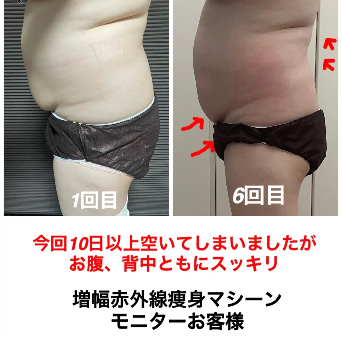 エステ ネイル・エステサロン UILANIのエステ・リラクイメージ