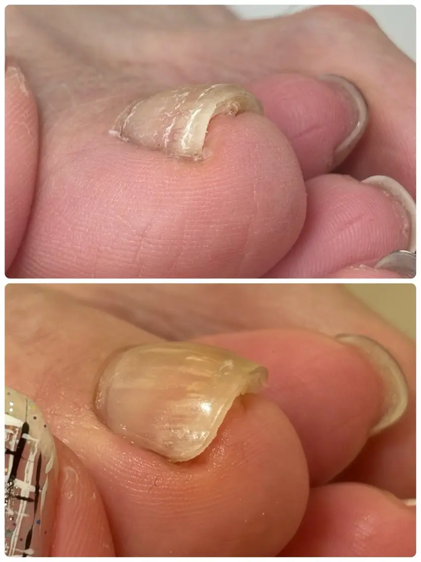 ネイル Alo.nail アロ•ネイルのネイルデザイン
